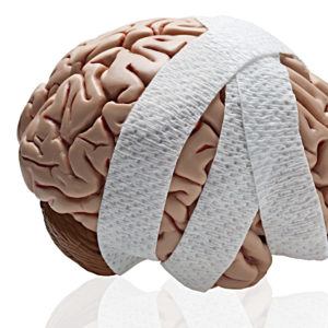 Genrebild hjärna med bandage.
